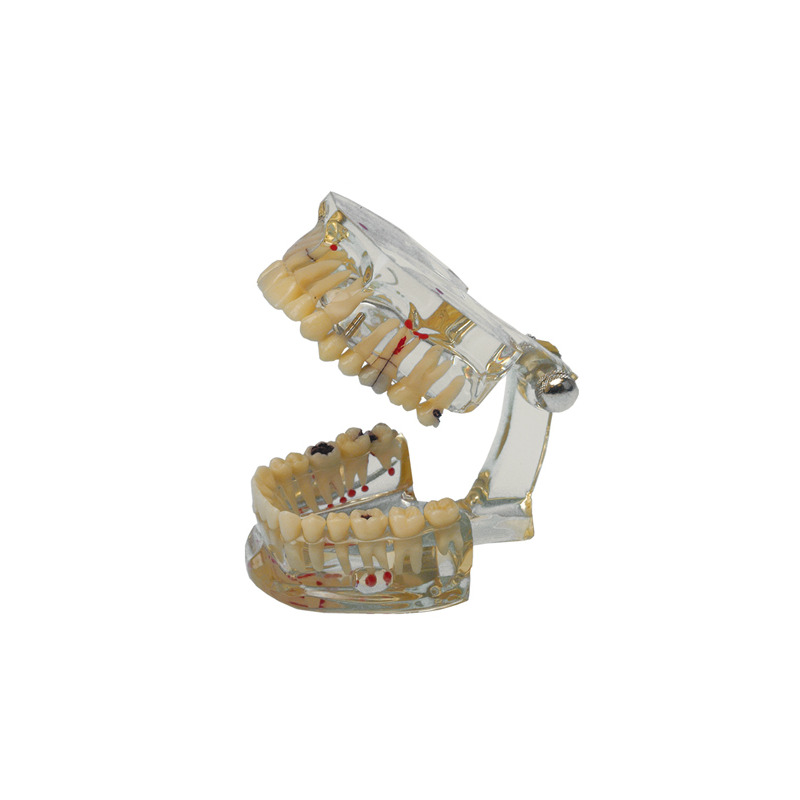 Model chrupu Transparent Plus