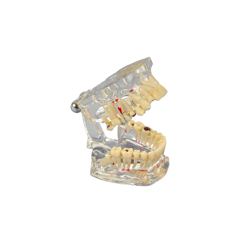Model chrupu Transparent De Luxe