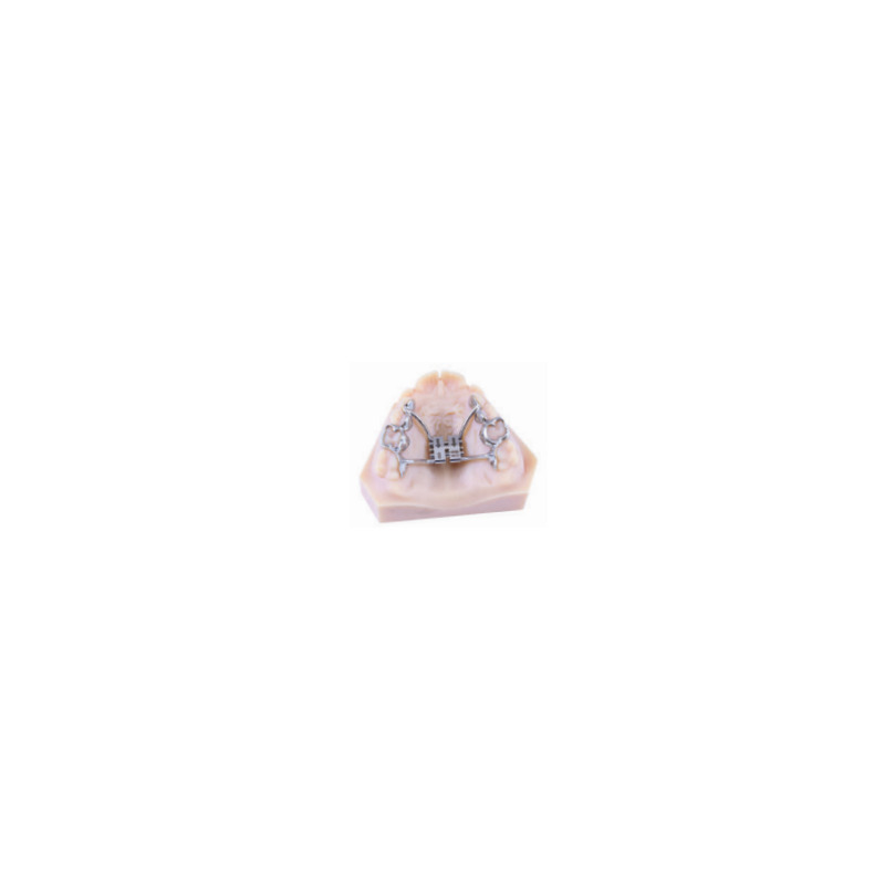 Patrový expanzní šroub CAD-CAM Tooth Borne 8 mm