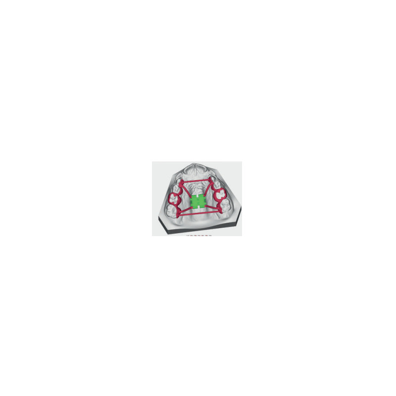 Patrový expanzní šroub CAD-CAM Tooth Borne 8 mm