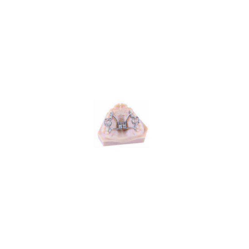Patrový expanzní šroub CAD-CAM Tooth Borne 11 mm
