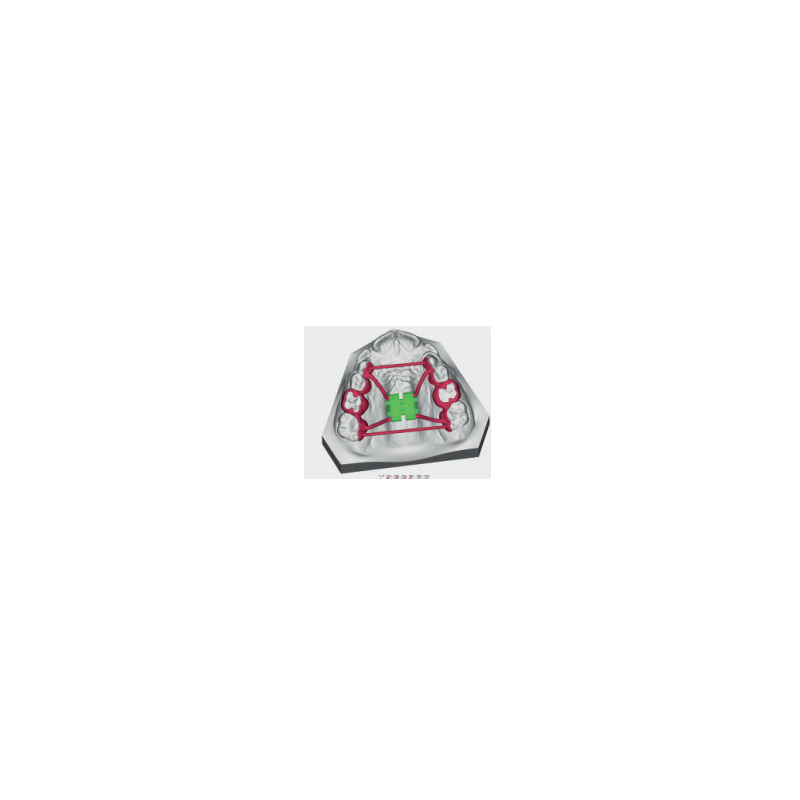 Patrový expanzní šroub CAD-CAM Tooth Borne 11 mm