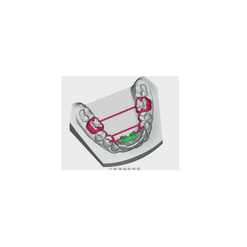 Expander CAD-CAM pro DČ 8 mm 1 ks