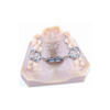 Micro Rapid Expander Easy Access 8 mm 1 ks