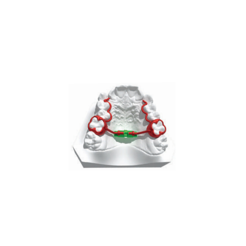Micro Rapid Expander Easy Access 11 mm 1 ks