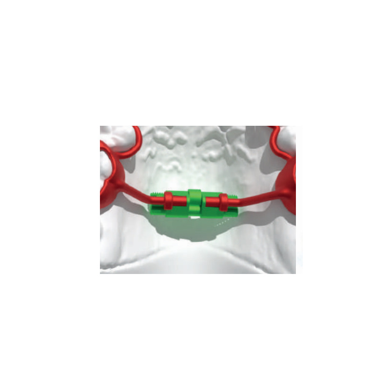 Micro Rapid Expander Easy Access 11 mm 1 ks