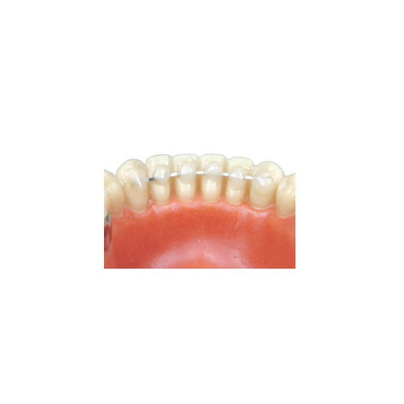 Retainer plochý drát 1,5m 1 ks
