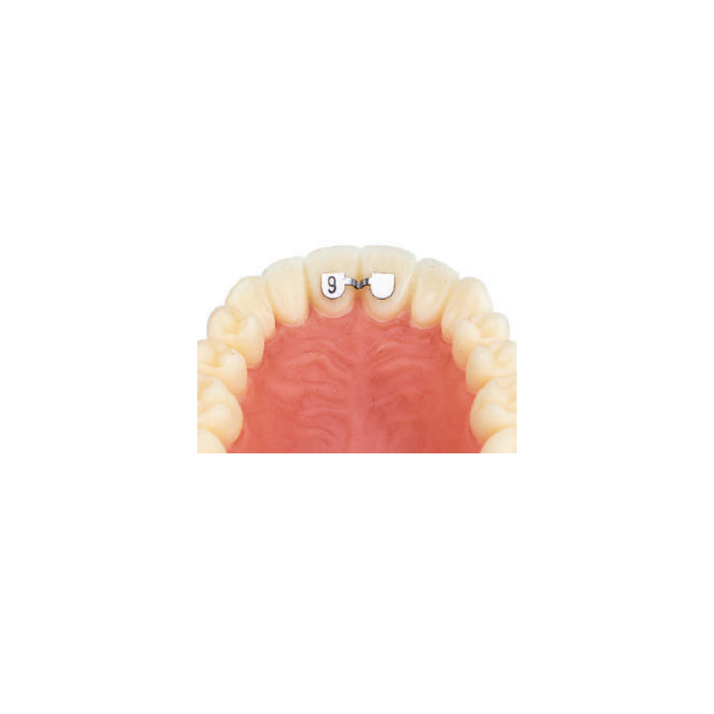 Retainer horní 1-1 10 ks