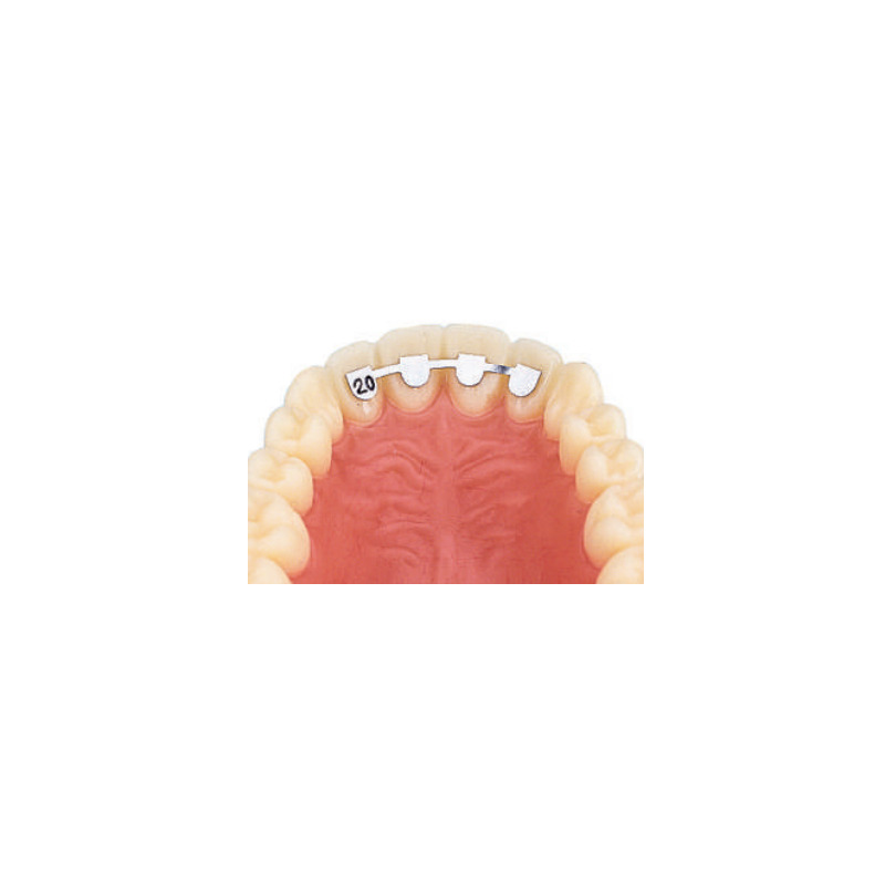 Retainer kit